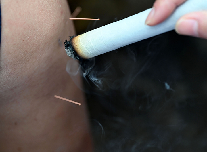 圖2  社區(qū)居民樂享針灸、艾灸等中醫(yī)適宜技術(shù)推廣帶來的中醫(yī)文化體驗(yàn)。.png